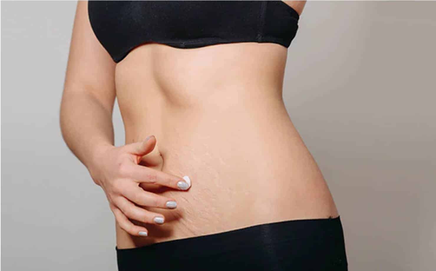 Barriga lisa: Adicione esta postura simples de ioga a sua rotina!