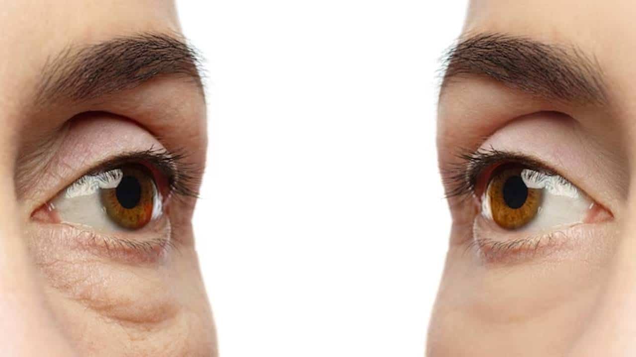 3 remédios naturais para REJUVENESCER os olhos e LEVANTAR as pálpebras caídas