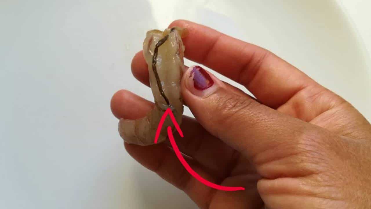 A tripa escura do camarão são fezes ou alimentos?