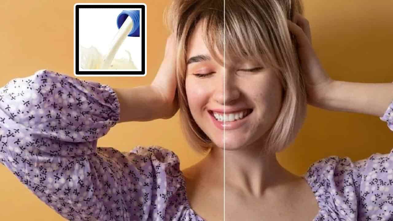 Como usar o leite de magnésia para CONTROLAR a oleosidade da pele e evitar acne?