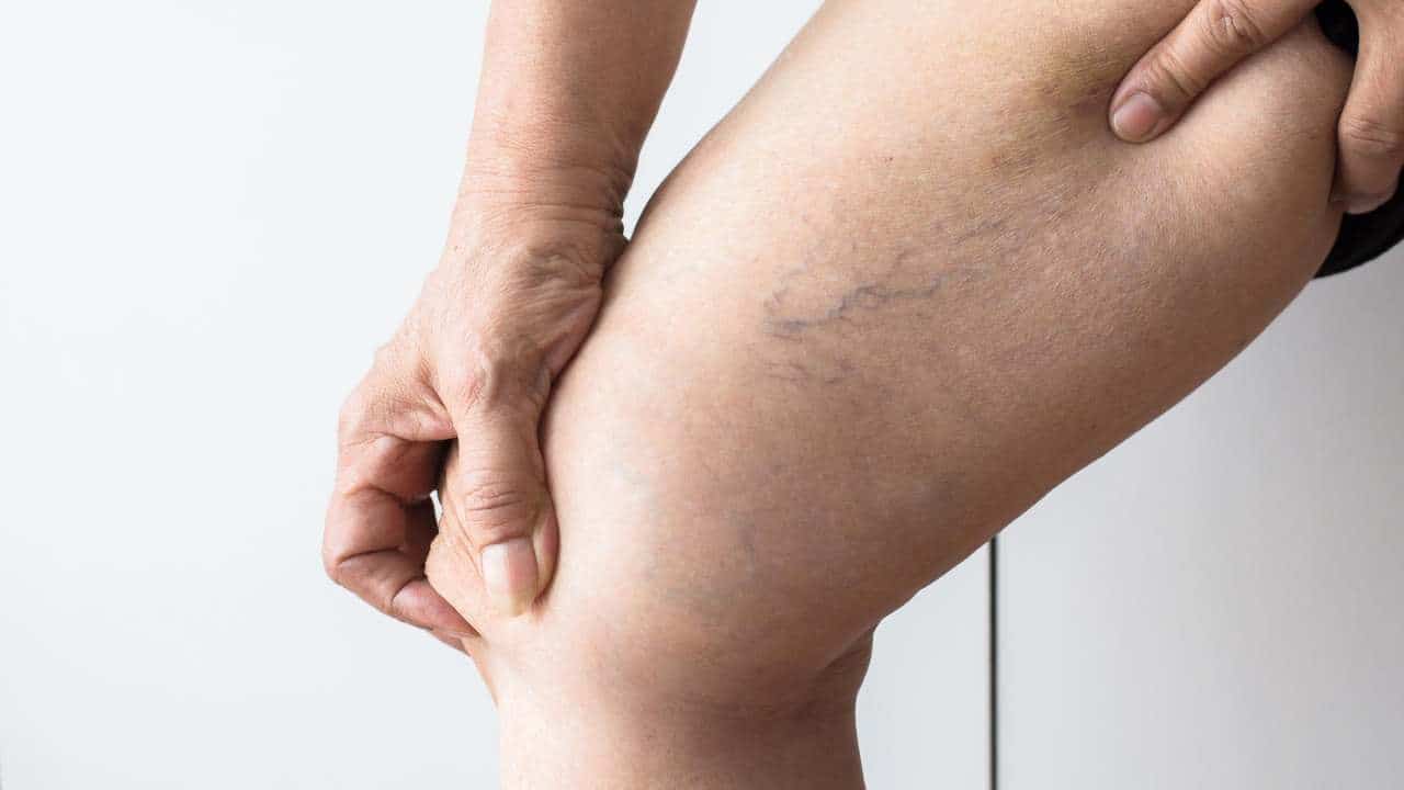 Planta que você coloca no shampoo para escurecer os cabelos grisalhos!